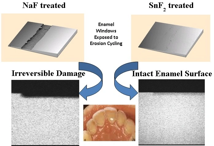 Diagram showing enamel windows exposed to erosion cycling.