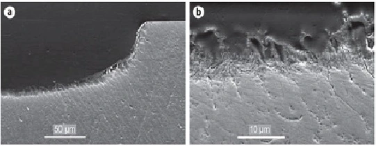 Images showing loss of enamel.